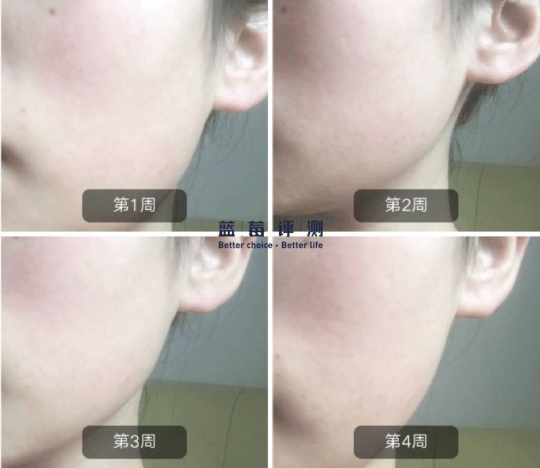 十大公认最好的美容仪,公认最好的美容仪推荐一下