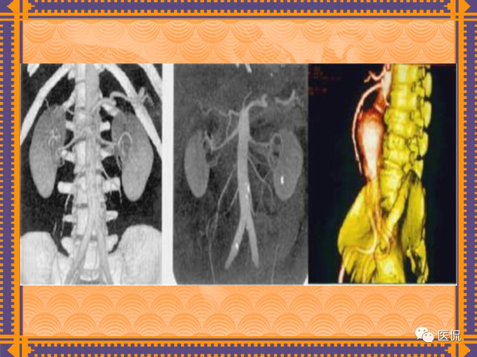 生殖系统疾病影像学诊断医学影像精品PPT