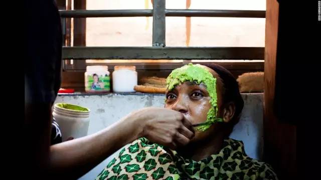 “我想变白，这样就会有更多男人来追我”