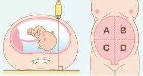 b超发现某些问题一定要处理么,b超发现问题需要处理吗