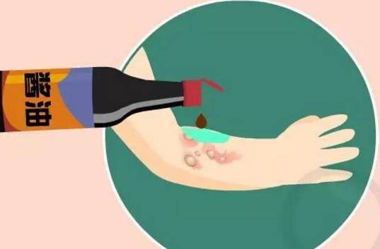 90度开水大面积烫伤急救,儿童开水烫伤急救处理