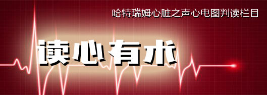 《读心有术》,读心有术265