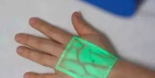 扎针如何进针不疼,怎么扎针最稳不鼓