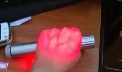 扎针如何进针不疼,怎么扎针最稳不鼓