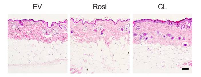 绝了绝了！华人科学家发明将「游泳圈」变为「八块腹肌」的「减肥神贴」，想瘦哪里贴哪里｜奇点猛科技
