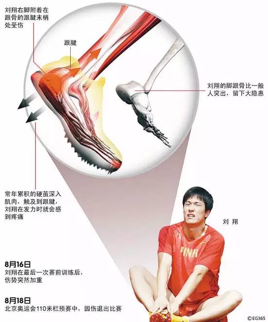 跟腱真的那么脆弱吗,跟腱为什么这么脆弱