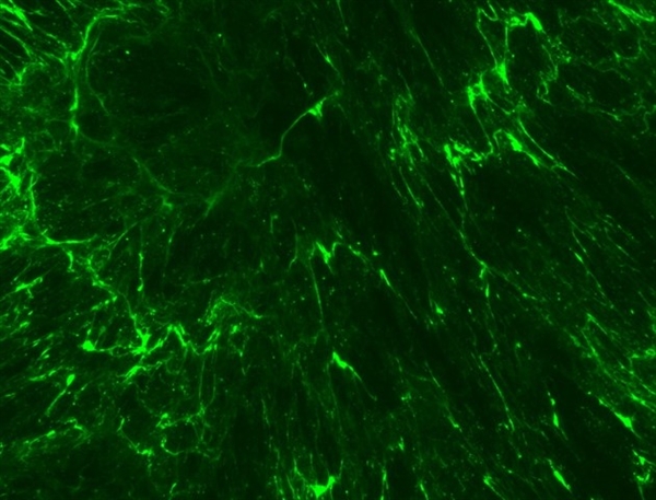 微整形安全与风险解析,脸部微整形有什么风险