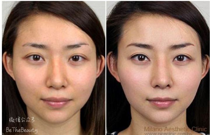 鼻翼宽鼻头大怎么办,塌鼻子鼻翼宽妆容