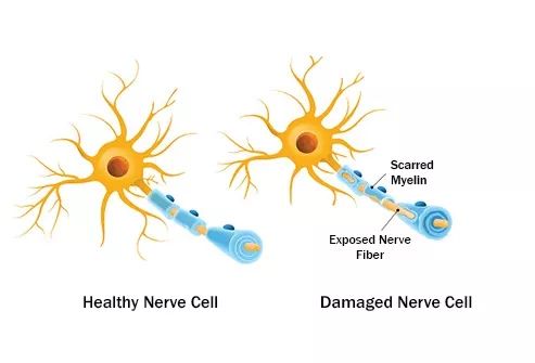 免疫系统出了问题是什么病,免疫系统出了问题会得什么病