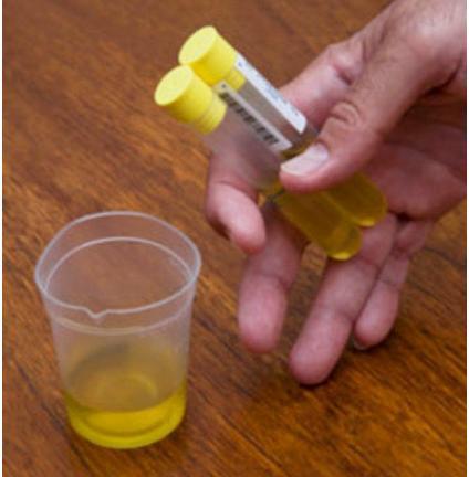 尿检指标科学解读！