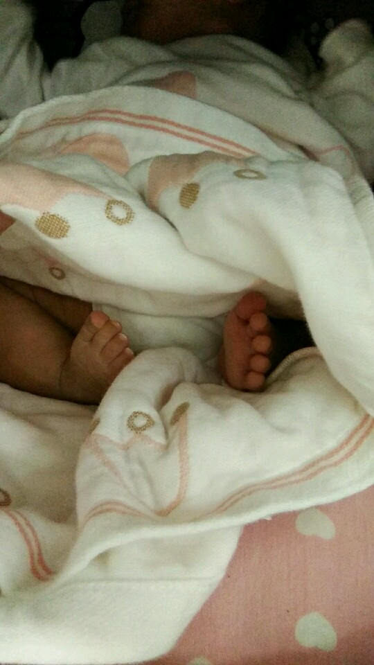 马蹄足内翻宝宝康复记，给相同经历的宝妈一些正能量