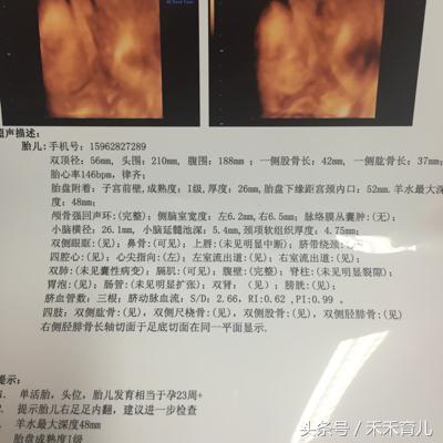 四维检查马蹄内翻有没有可能误诊,四维马蹄足和足内翻一样吗