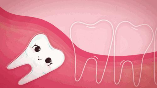 微创阻生齿拔除需要多久,微创复杂牙拔除术阻生智齿