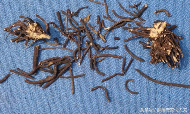 食管癌最怕的一种中药,白花蛇舌草治食道癌的偏方