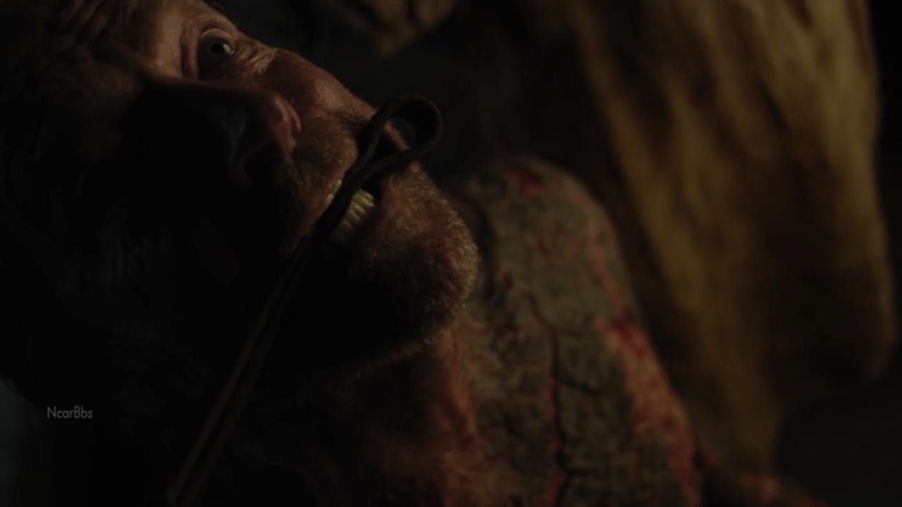 山姆为乔拉爵士刮皮治疗灰麟病你们觉得乔拉会好起来吗?