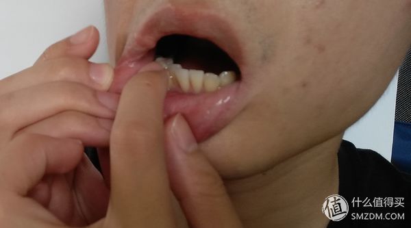 家庭医护小药箱,家庭用的医疗急救药箱