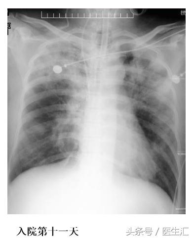 医生可以救多少病,医生要救人吗