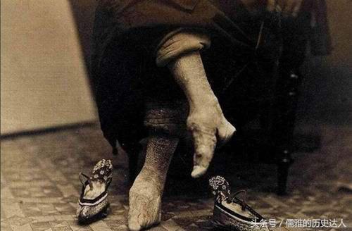 古代的缠足对女性的摧残有多大?为何古代男人们喜欢‘三寸金莲’
