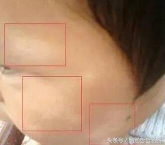 宝宝肚子有虫子吃什么打虫药,怎么判断孩子肚子里有虫需要打虫