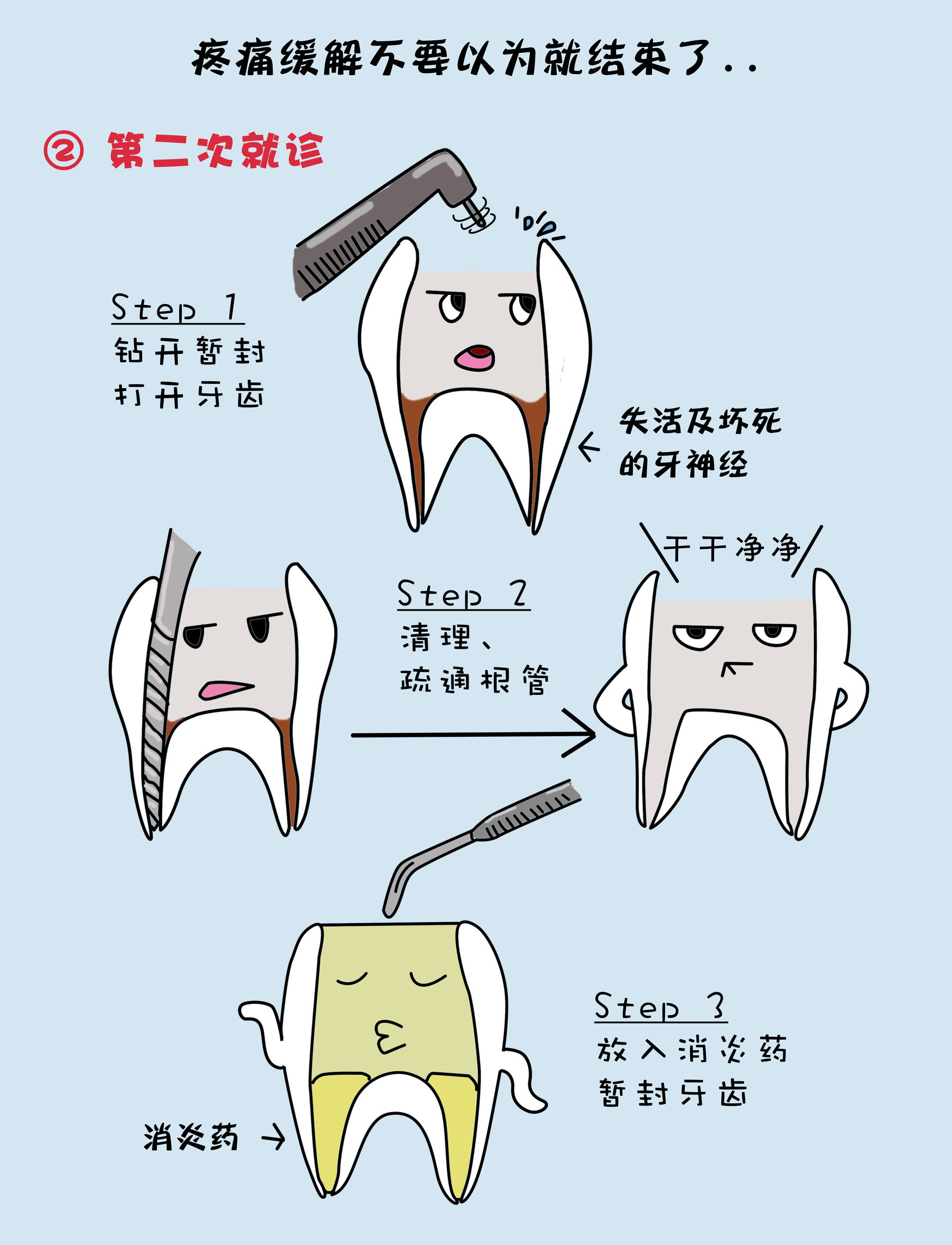 根管治疗是什么作用,根管治疗是什么情况下要做