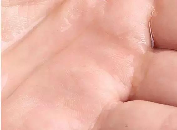 如何不挤就可以去黑头,黑头别再用手挤三个去黑头小妙招