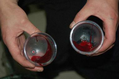 蛇毒急救,中蛇毒正确急救方法是什么