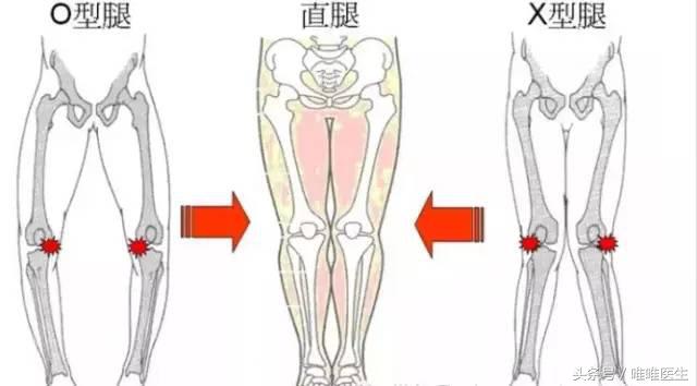 膝盖疼痛治疗经验分享,膝关节总结