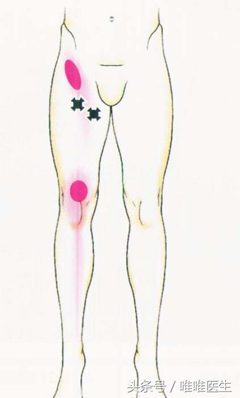 膝盖疼痛治疗经验分享,膝关节总结