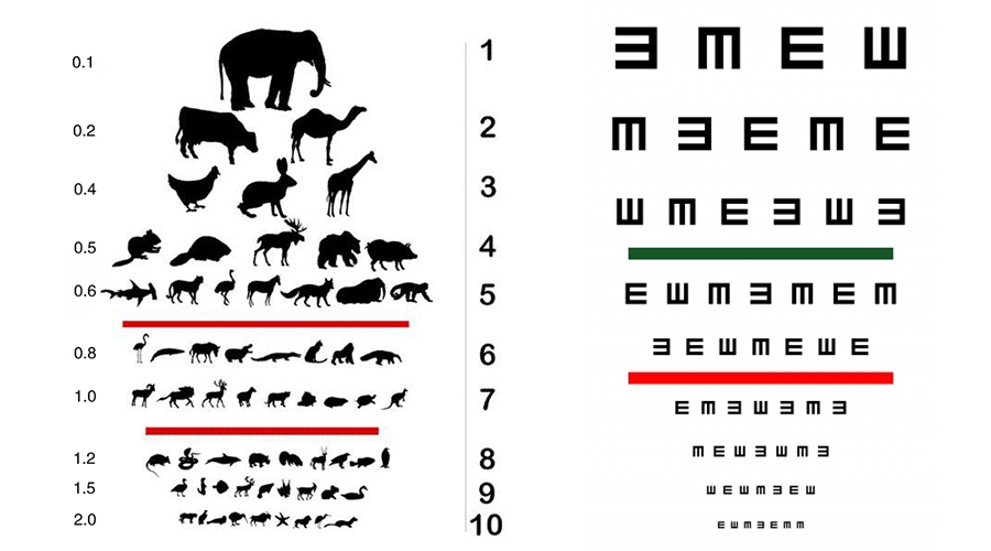 郑医生科普小知识,郑医生讲弱视