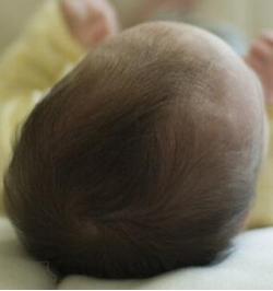 广州哪家医院可以矫正儿童头型,孩子头型问题