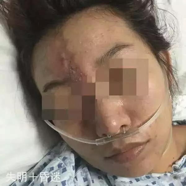 医疗整形赚钱吗,整形行业水太深套路多