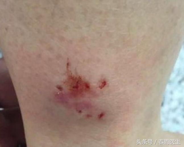 被人咬了能让对方赔偿吗,被人咬了要赔钱吗