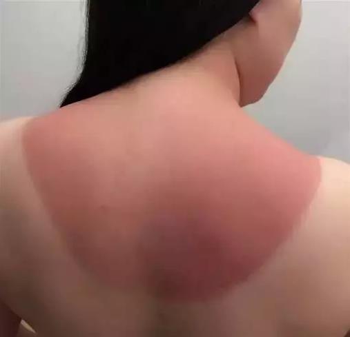 安耐晒防晒霜怎么样辨别真伪,防晒霜买到假货怎么证明是假货