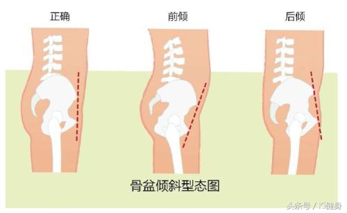 腘绳肌和半月板间隙,膝关节半月板根部解剖