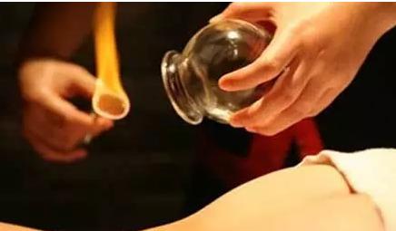 腰肌劳损梨状肌做针灸拔罐有用吗,腰肌劳损拔罐注意事项