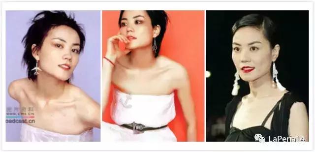 骨性方脸怎么瘦脸,方脸怎么改善脸型整骨