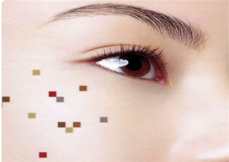 色素痣癌变会发生什么,色素痣正在恶变有什么表现