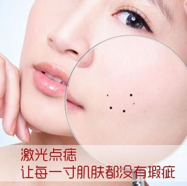 黑痣癌变脸部的痘印会变黑吗,黑痣发生这些变化时要警惕恶变