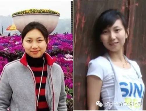 她们说||那些年整牙吞下的血和泪,终于换来最开怀的大笑