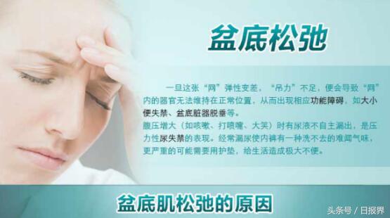 kegel盆底康复仪培训,kegel盆底康复仪使用方法