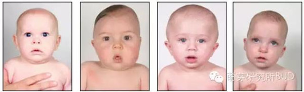 宝宝偏头莫担忧预防纠正有妙招,宝宝偏头的最佳治疗方法