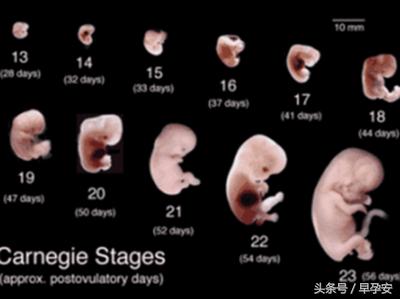 孕妇多久能有胎芽胎心,准妈妈孕早期注意事项