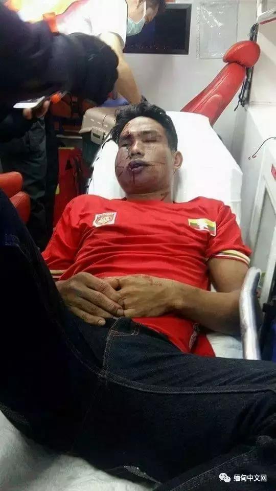 球迷被暴打后续,球迷被围殴后续