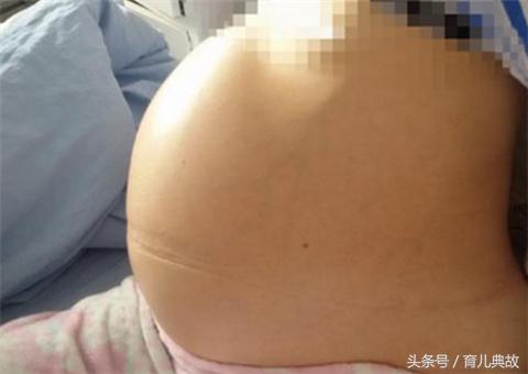 肚子越来越大胎动会越来越明显吗,突然觉得肚子变大胎动减少的原因