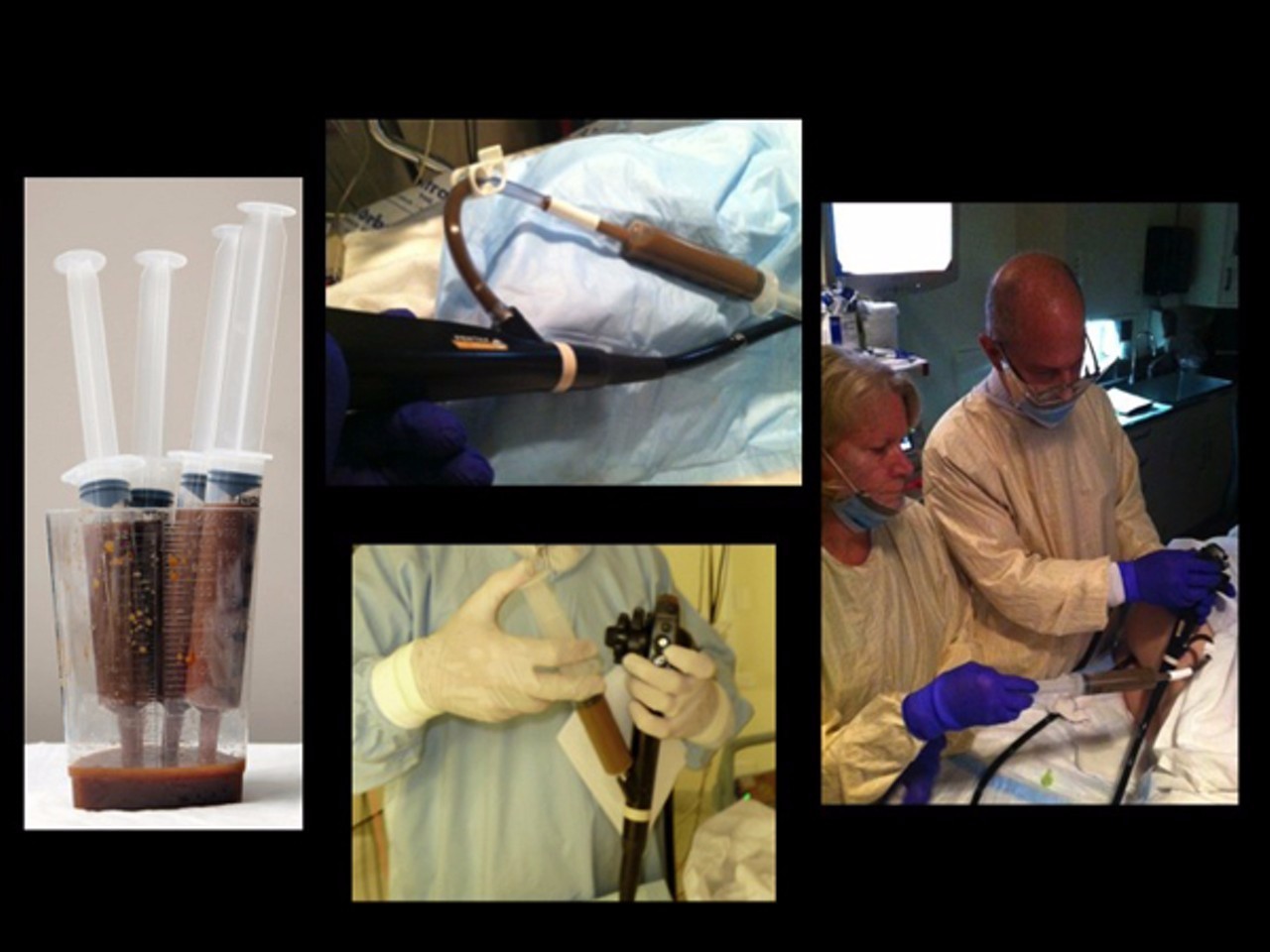 你狠心冲掉的便便,正成为许多肠胃病人的救星