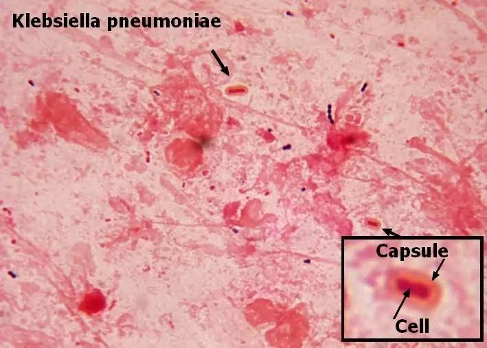 你狠心冲掉的便便,正成为许多肠胃病人的救星