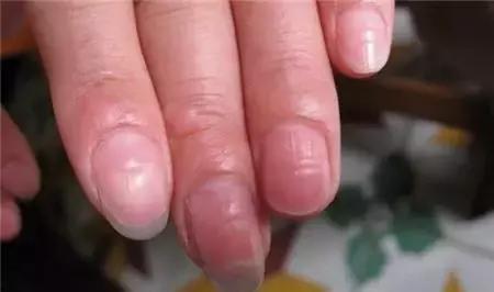 指甲上的月牙预示着什么,指甲上的月牙真的和健康有关系吗