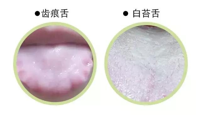 中医养生16个穴位帮你排湿气,中医养生这几种食物越吃湿气越重