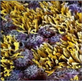 输卵管积水能移植吗,输卵管为什么会有积水