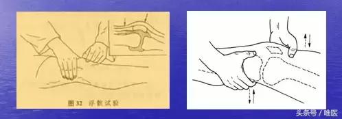 前交叉韧带损伤需要多久康复,膝盖前交叉韧带损伤中医治疗方法